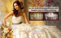 Wedding Bridal Smile Makeover SPECIALS & PACKAGES image 3